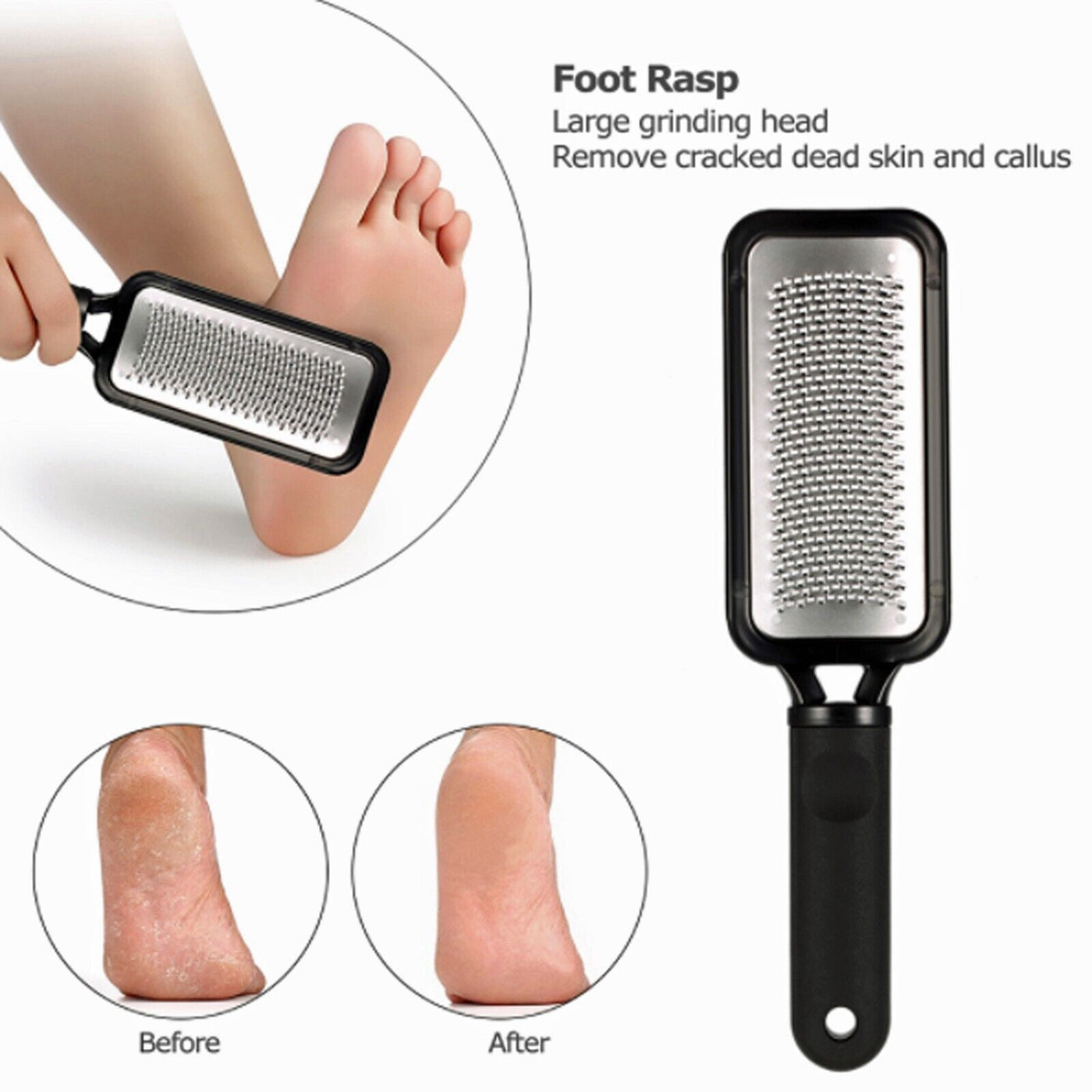 Black Foot File Callus Remover