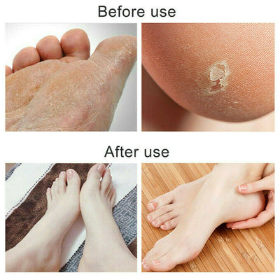 Black Foot File Callus Remover